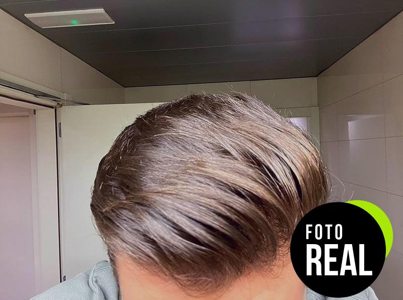 vitaminas-cabello-nutralie-2022-pelo-vegetariano-foto-2